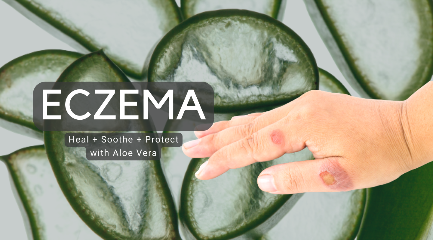 A Natural Solution for Eczema: Unlocking the Secrets of Aloe Vera